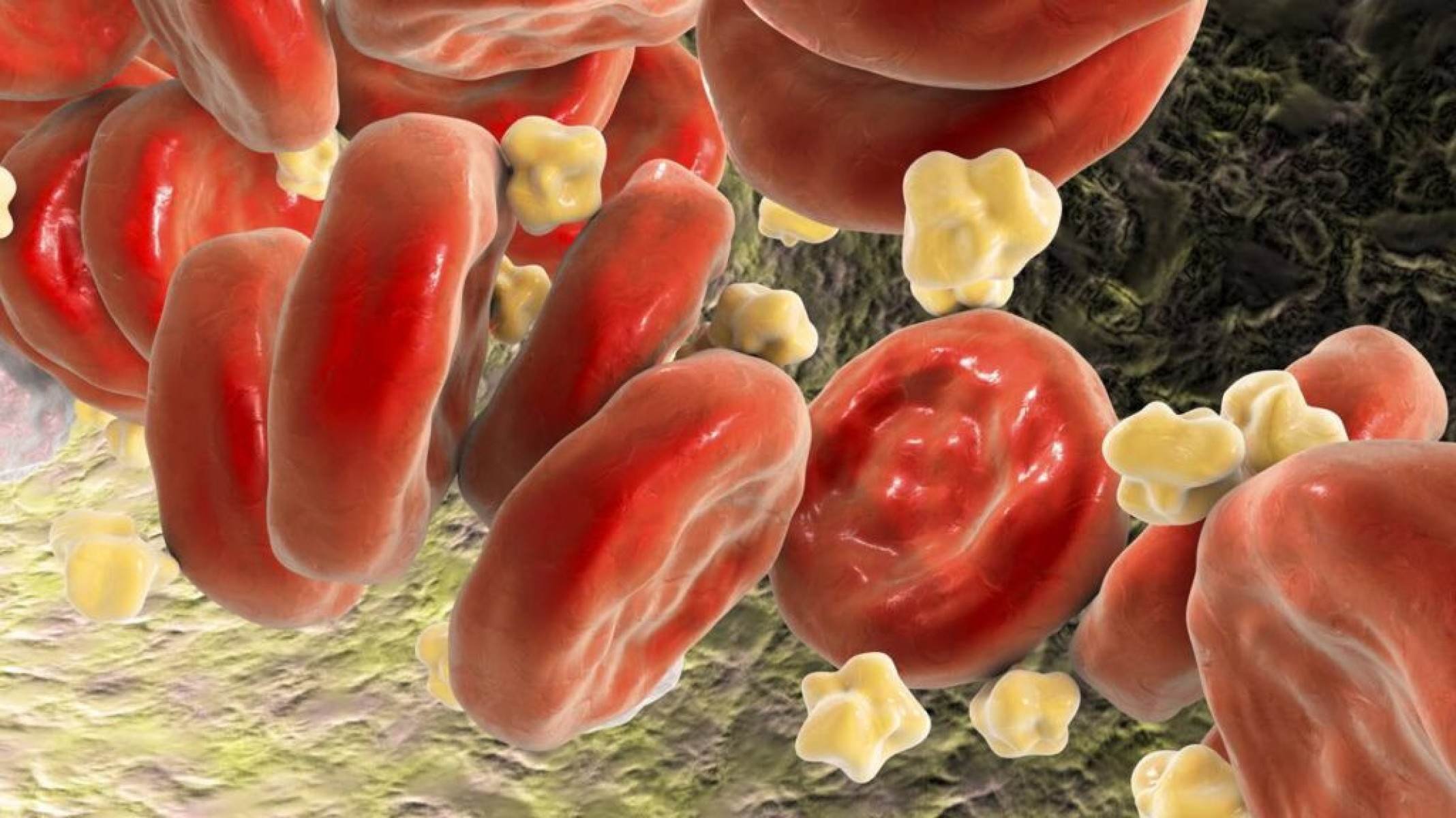 Estatinas: como funcionam, benefícios e cuidados necessários - Portal Giro 10