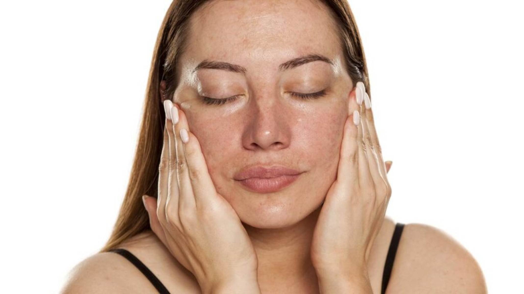 Melasma: tratamentos eficazes e cuidados essenciais para clarear a pele - Portal Giro 10