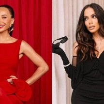 Famosas aderem à bioestimulação de colágeno para melhorar a pele - Reprodução/Instagram