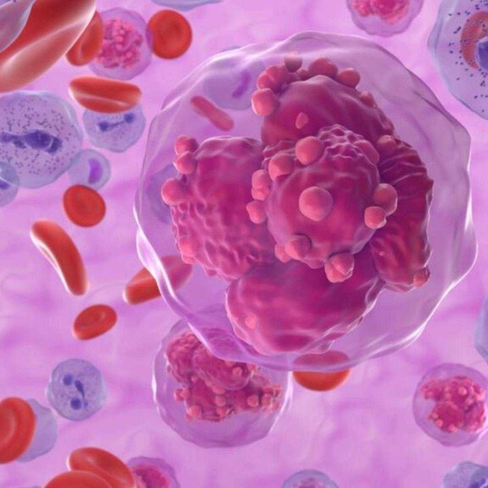 Campanha reforça importância do diagnóstico precoce das doenças do sangue