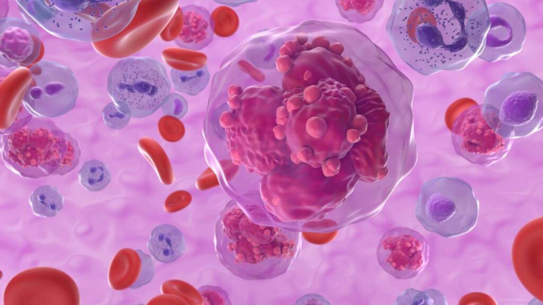 Por que a leucemia é o câncer mais comum em crianças e jovens? - Portal Giro 10