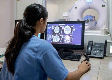 Como a menopausa pode afetar o cérebro de forma semelhante ao Alzheimer -  (crédito: BBC)