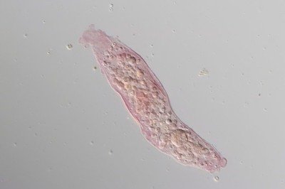 <p>Um estudo publicado em dezembro e divulgado no dia 25 de janeiro alerta para o avanço das chamadas “amebas de vida livre”.</p>
 -  (crédito: Wikimedia Commons/Dalinda Bouraoui)