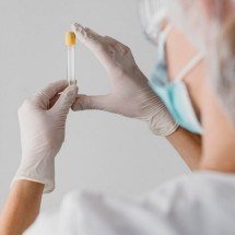 Saiba quais drogas são detectadas no exame toxicológico para CNH - Freepik