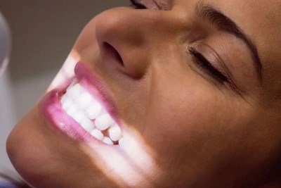 Mulher exibe dentes que passaram pelo processo de clareamento com o método conhecido como fita dental -  (crédito:  Freepik)