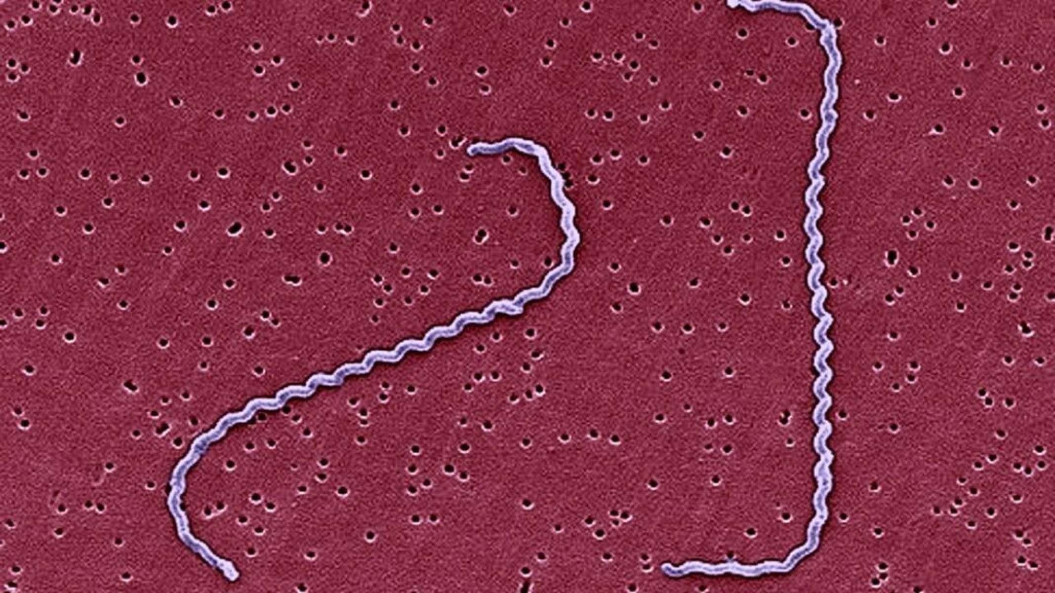 Leptospirose: conheça sintomas, causas e tratamento - Portal Giro 10
