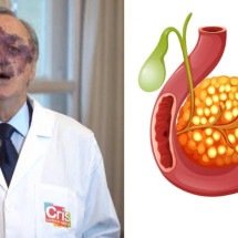 Estudo espanhol alcança eliminação total de câncer de pâncreas em cobaias - Reprodução/X