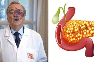 Estudo espanhol alcança eliminação total de câncer de pâncreas em cobaias