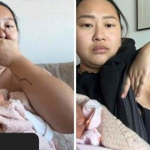 Mulher desenvolve terceiro seio depois do parto - TikTok / reprodução