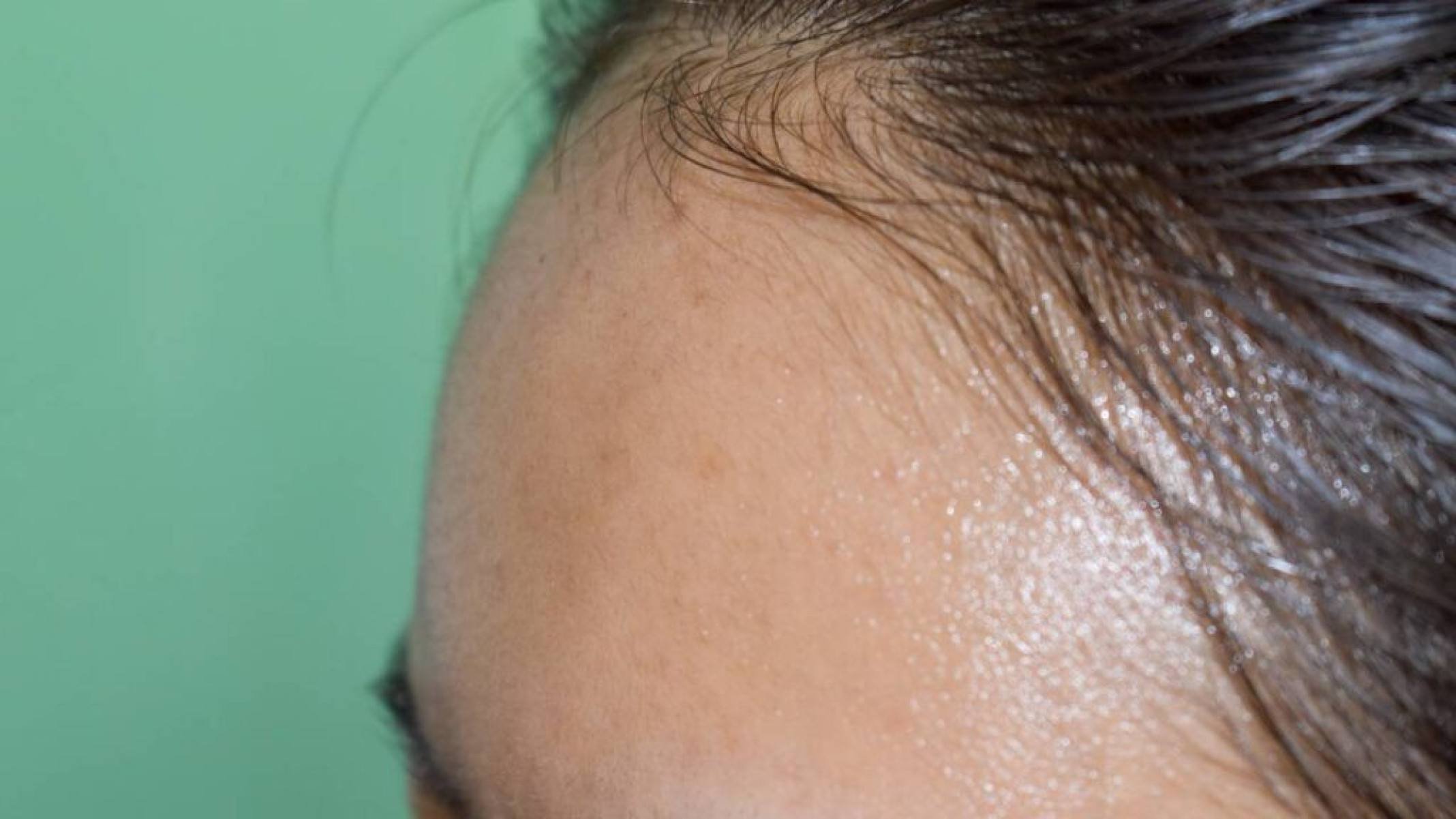 Pele oleosa sob controle: dicas sem agredir os fios - Portal Giro 10