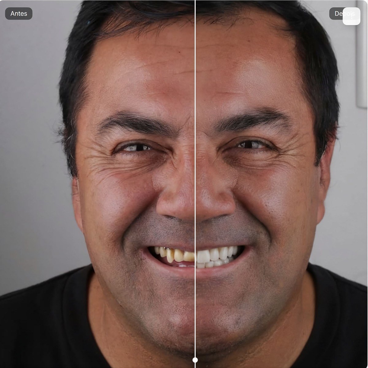 Tecnologia ajuda dentistas a prever resultados estéticos - DINO