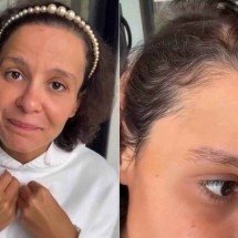 Cantora Maiara desabafa sobre alopecia androgenética - Reprodução/Redes Sociais