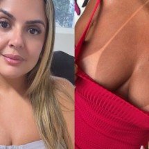 Câmaras de bronzeamento artificial aumentam risco de melanoma e mutações - Arquivo Pessoal