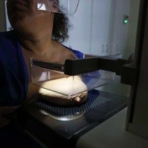 Vigitel: 92% das brasileiras entre 50 e 69 anos fizeram mamografia - José Cruz/Agência Brasil