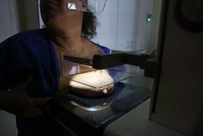 Exame de mamografia  -  (crédito: Jos&eacute; Cruz/Ag&ecirc;ncia Brasil)