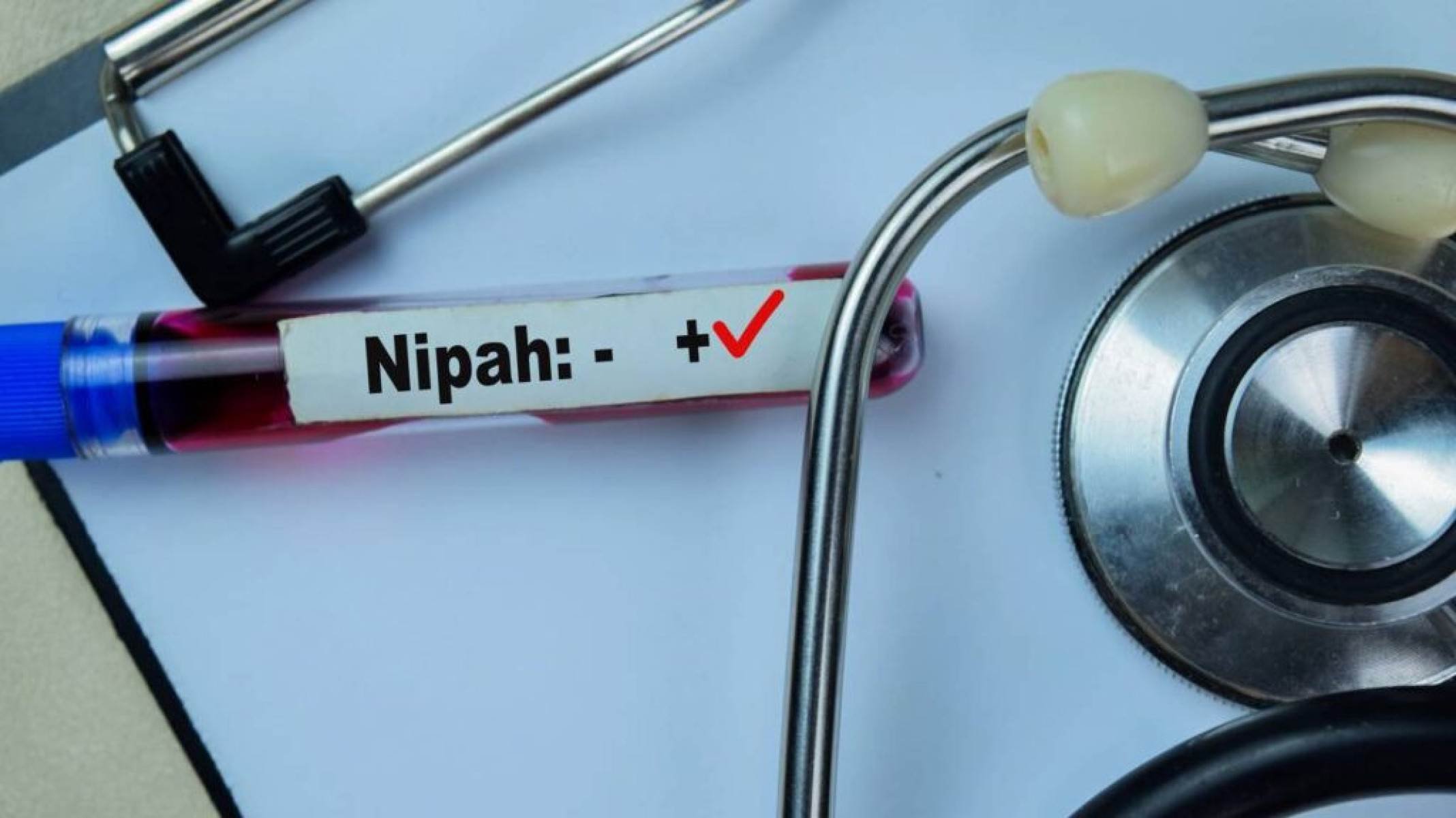 Do morcego ao porco: entenda a cadeia de transmissão do vírus Nipah - Portal Giro 10