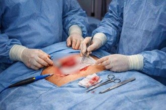 Erro em cirurgia de hérnia faz homem perder um testículo 