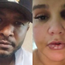 Grande BH: cantor acusado de espancar ex diz que ela o agrediu por 4 anos - Redes sociais/Reprodução