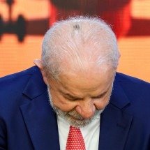 Lula aparece com mancha na cabeça após cauterização