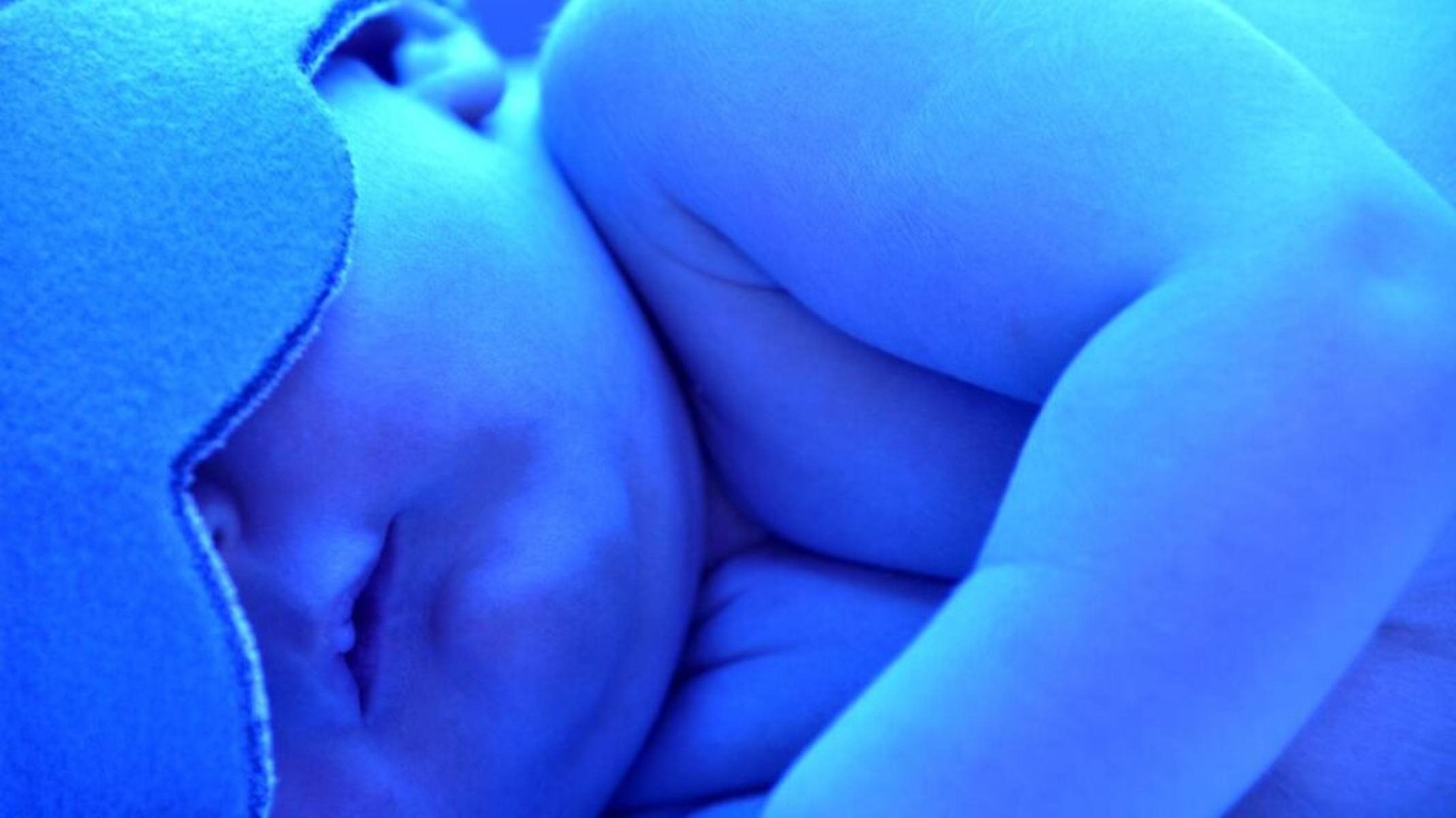 Do fígado às vias biliares: o que a icterícia revela sobre o corpo - Portal Giro 10