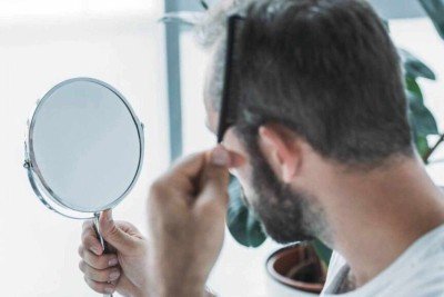 Alopecia androgenética: entenda a condição que afeta a cantora Maiara -  (crédito: Portal Giro 10)