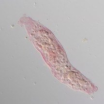 Cientistas em alerta: aquecimento global causa espalhamento global de amebas mortais - Wikimedia Commons/Dalinda Bouraoui