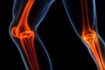 Sarcoma de Ewing: o c&acirc;ncer raro que afeta jovens e adolescentes -  (crédito: Portal Giro 10)