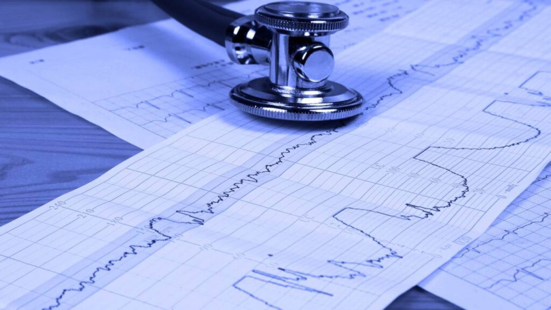 Fim da exclusividade do Procoralan promete tratamento cardíaco mais acessível - Portal Giro 10