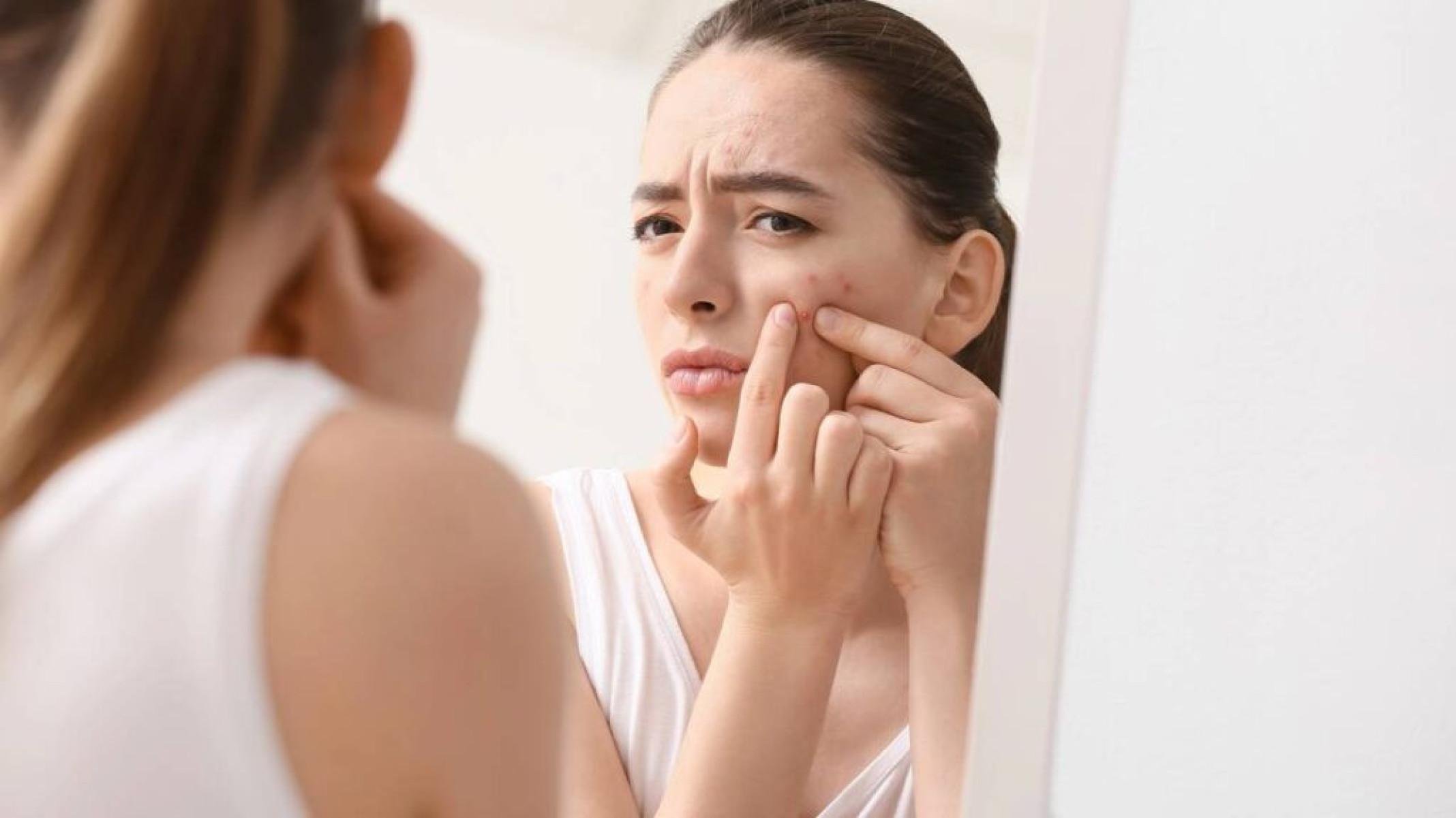 Dermatilomania: o transtorno que leva a pessoa a arrancar a própria pele - Portal Giro 10