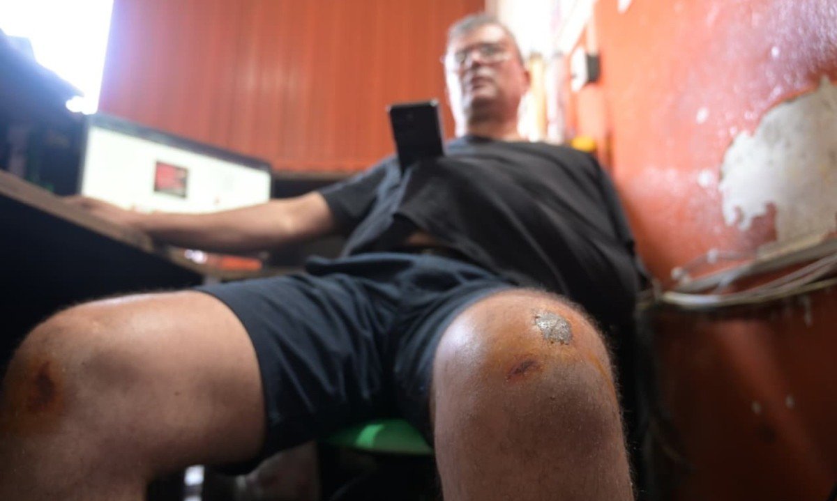 O empres&aacute;rio sofreu fraturas nas costelas e na clav&iacute;cula, al&eacute;m de diversas escoria&ccedil;&otilde;es pelo corpo