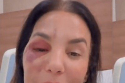 <p>A cantora Ivete Sangalo reapareceu nas redes sociais no dia 2 de março para tranquilizar os fãs após passar por uma cirurgia no rosto. A artista sofreu uma queda e precisou operar depois de fraturar dois ossos na região da maçã do rosto. Mesmo com edemas visíveis, ela fez uma live diretamente do hospital para dar o que chamou de “notícias maravilhosas”. </p>
 -  (crédito: Reprodução de redes sociais )