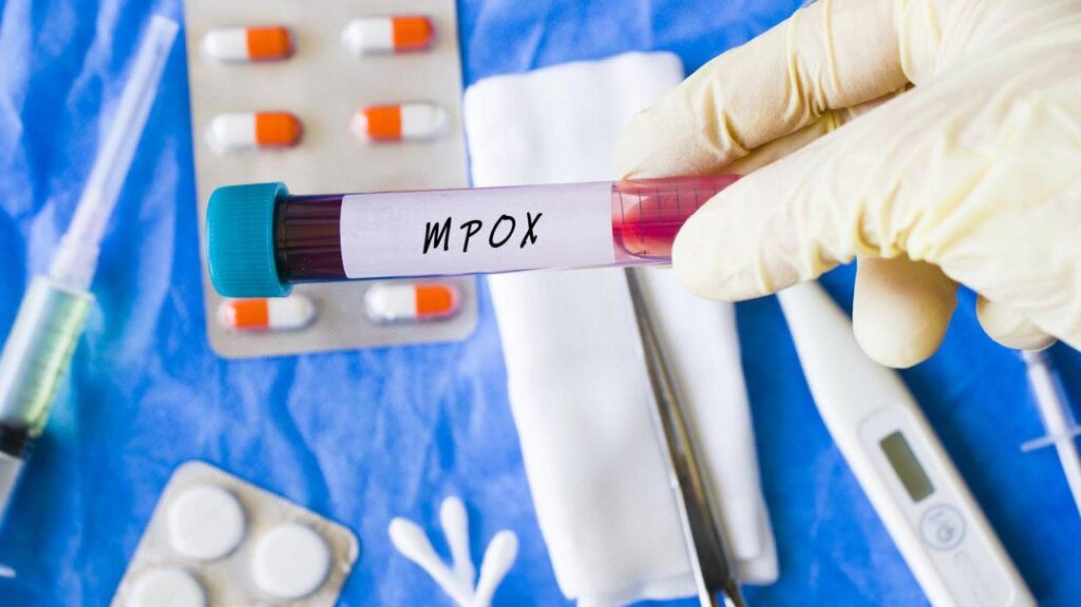 Mpox não é varíola humana: entenda as diferenças entre os vírus - Portal Giro 10