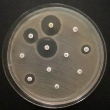 Bactérias resistentes são descobertas fora de ambiente hospitalar         - Thais Martins Gonçalves/ICB-USP