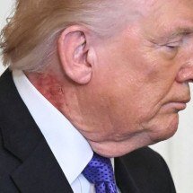 Trump aparece com grande mancha vermelha no pescoço - SAUL LOEB / AFP