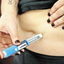 Por que, sozinhas, as canetas emagrecedoras não escrevem uma nova história - Leandro Couri/EM/D.A Press