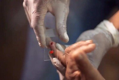 Crianças concentram 50% dos casos de malária no país -  (crédito:  TV Brasil/Reprodução)