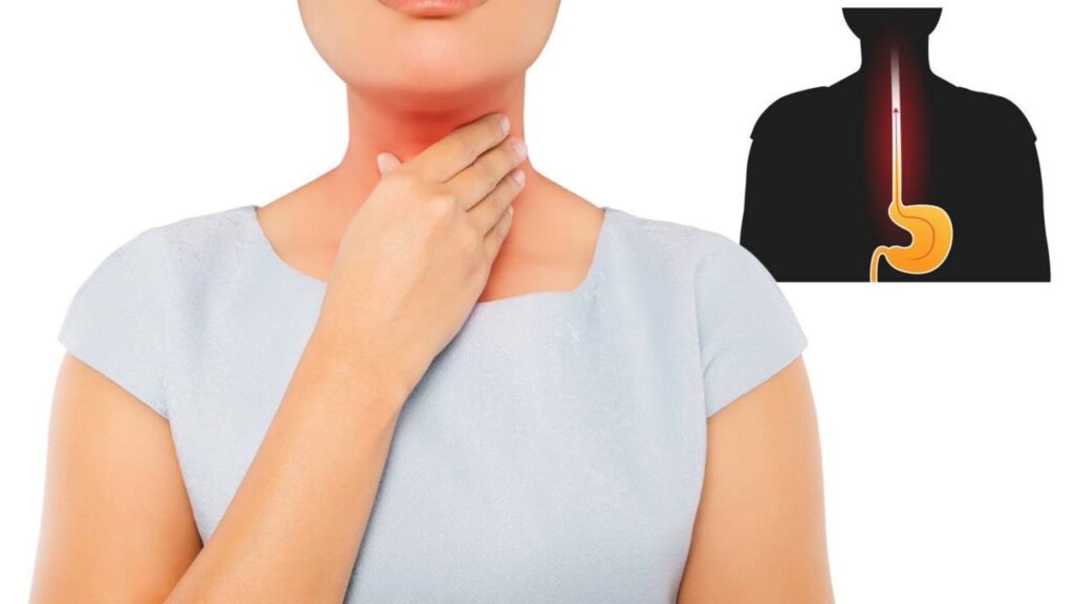 Refluxo gastroesofágico: sintomas, causas e tratamentos explicados - Portal Giro 10