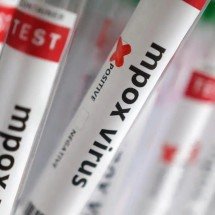 Sobe para 140 número de casos confirmados de Mpox no país, em 2026 -  Reuters/Dado Ruvic/proibida a reprodução