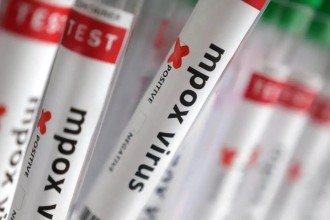 Sobe para 140 número de casos confirmados de Mpox no país, em 2026