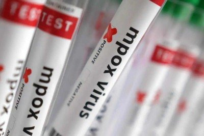 Estado que mais registrou casos da doença foi São Paulo, com 93 -  (crédito:  Reuters/Dado Ruvic/proibida a reprodução)