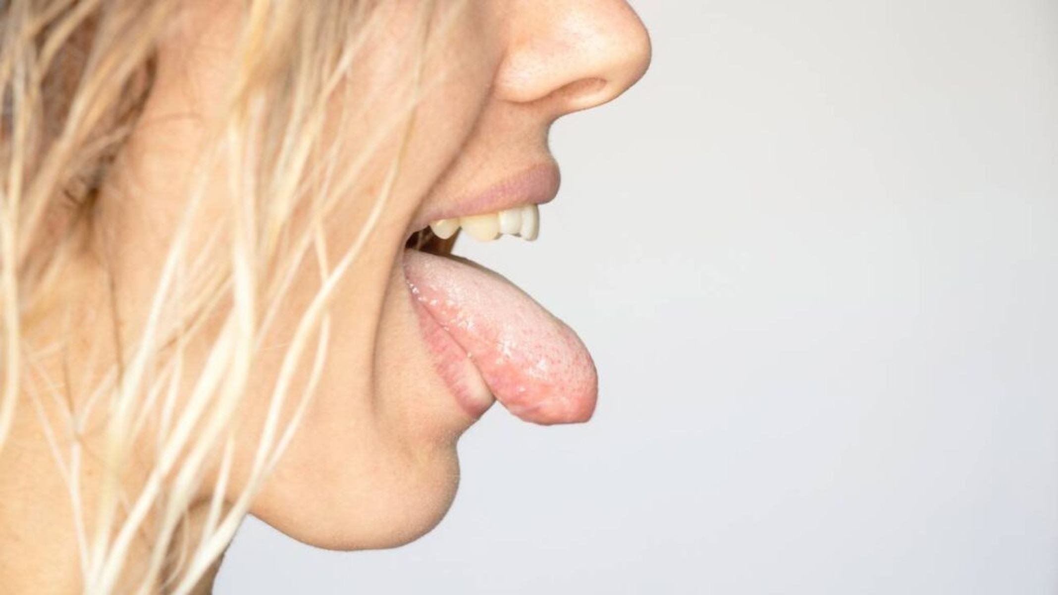 Descubra as bactérias que vivem na sua saliva e seu papel na saúde - Portal Giro 10