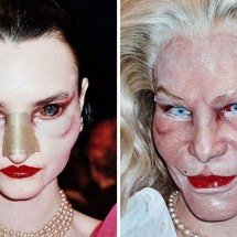 Modelos com rostos 'pós-cirurgia' chocam desfile em Paris - Matières Fécales 