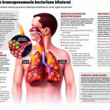 Quadro de Bolsonaro é grave - Valdo Vigo