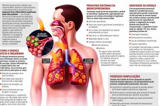 Quadro de Bolsonaro é grave