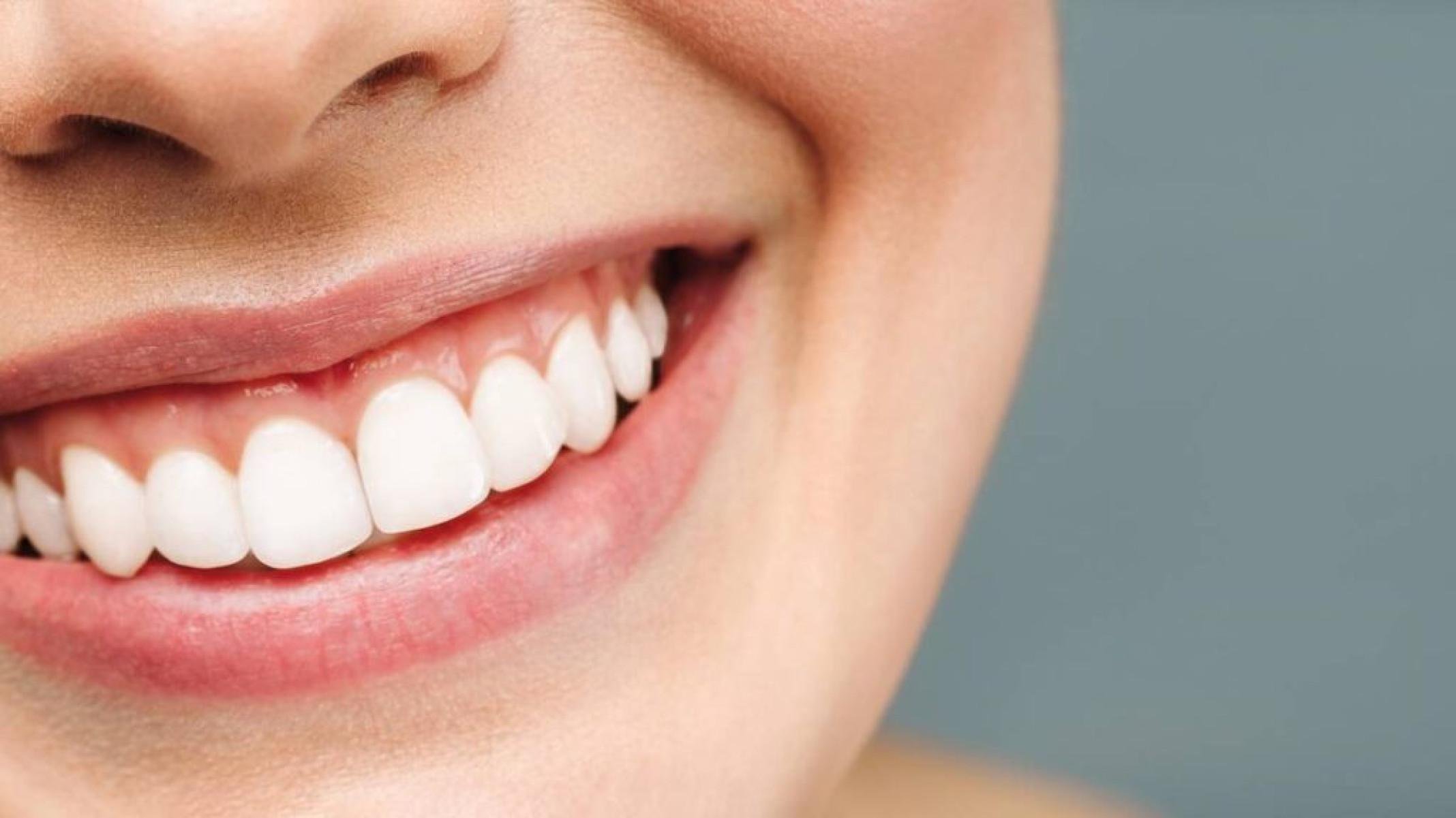 Contenção fixa: o segredo para dentes alinhados após o aparelho - Portal Giro 10