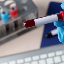 Exame de apolipoproteína (a) pode ser decisivo na saúde do coração - rawpixel.com/FreePik