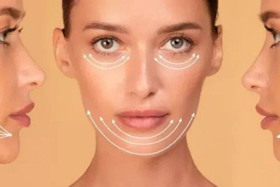 O procedimento consiste em um conjunto de t&eacute;cnicas est&eacute;ticas minimamente invasivas que buscam equilibrar as propor&ccedil;&otilde;es e tra&ccedil;os do rosto, promovendo uma apar&ecirc;ncia mais sim&eacute;trica e rejuvenescida -  (crédito: FreePik)