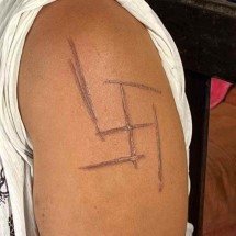 Mulher trans é torturada e marcada com símbolo nazista em MS - Reprodução/TV Morena