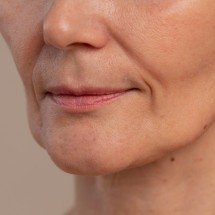 Ozempic face: emagrecimento rápido envelhece o rosto? - FreePik