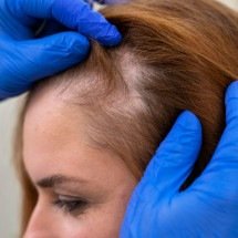 O papel das sementes na saúde dos fios e como incluí-las na alimentação - Divulgação 